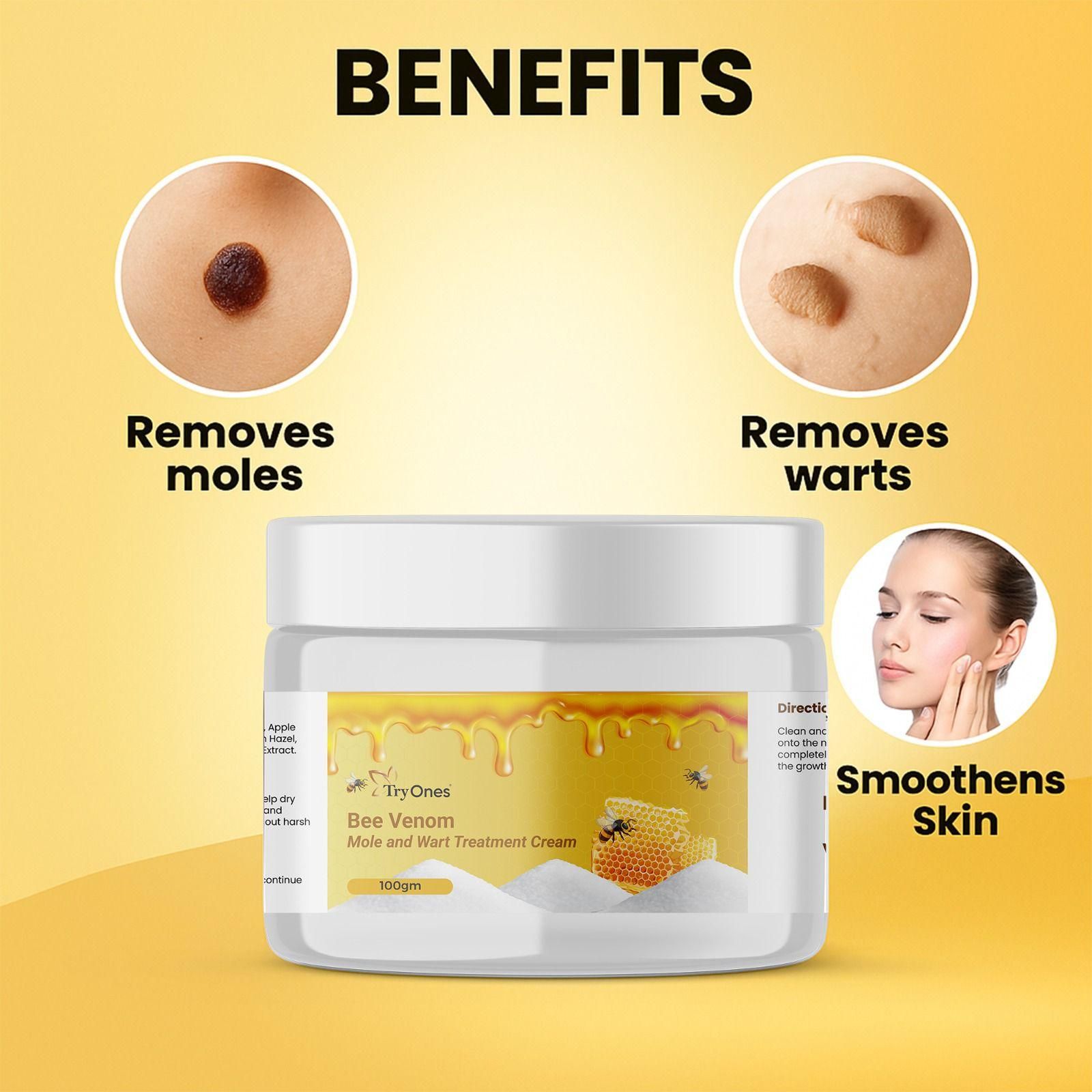 Bee Venom Mole and Wart Treatment Cream 200 gm Pack of 2